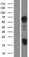 JRK Human Over-expression Lysate