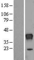 Ribonuclease T2 (RNASET2) Human Over-expression Lysate