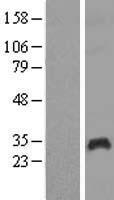 PAGE1 Human Over-expression Lysate