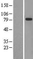 GMP Synthase (GMPS) Human Over-expression Lysate