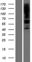 SGPL1 Human Over-expression Lysate
