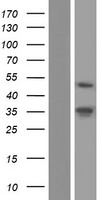 PAX2 Human Over-expression Lysate