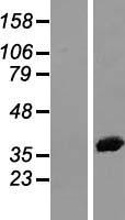 Annexin A2 (ANXA2) Human Over-expression Lysate