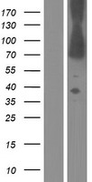 Dystrophin (DMD) Human Over-expression Lysate