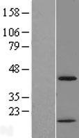 CHI3L2 Human Over-expression Lysate