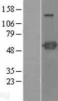 PSTPIP1 Human Over-expression Lysate