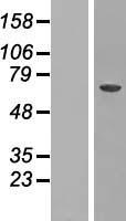 CRAT Human Over-expression Lysate