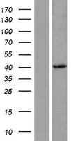 ASMT Human Over-expression Lysate