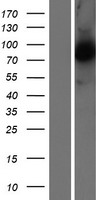 Calpain 5 (CAPN5) Human Over-expression Lysate