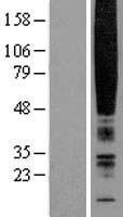 CMKLR1 Human Over-expression Lysate