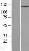 DCTN1 Human Over-expression Lysate