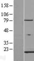 FABP3 Human Over-expression Lysate