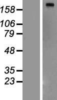 Fatty Acid Synthase (FASN) Human Over-expression Lysate