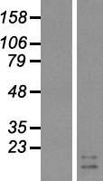 GIP Human Over-expression Lysate