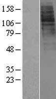 Ghrelin Receptor (GHSR) Human Over-expression Lysate