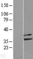PP2A-beta (PPP2CB) Human Over-expression Lysate