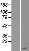 Peptide YY (PYY) Human Over-expression Lysate