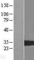 PSMB8 Human Over-expression Lysate