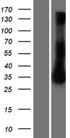 RRAD Human Over-expression Lysate