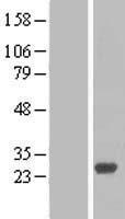 RAB27B Human Over-expression Lysate