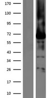 Bestrophin (BEST1) Human Over-expression Lysate