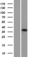 GFI1B Human Over-expression Lysate