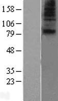 SLC28A1 Human Over-expression Lysate