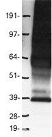 GPR10 (PRLHR) Human Over-expression Lysate