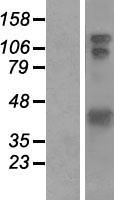 HOMER1 Human Over-expression Lysate