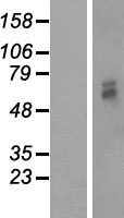 PMPCB Human Over-expression Lysate