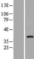 UCP4 (SLC25A27) Human Over-expression Lysate