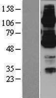 ABCB7 Human Over-expression Lysate