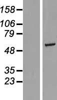 RGS6 Human Over-expression Lysate