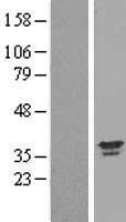 Annexin A13 (ANXA13) Human Over-expression Lysate