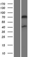 Drebrin (DBN1) Human Over-expression Lysate