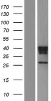 Cathepsin H (CTSH) Human Over-expression Lysate