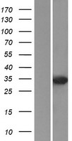DUSP2 Human Over-expression Lysate