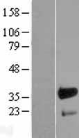 FHL3 Human Over-expression Lysate