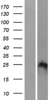 HOXB7 Human Over-expression Lysate