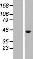 IL11RA Human Over-expression Lysate
