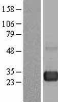 RAB7 (RAB7A) Human Over-expression Lysate