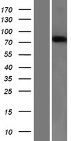 Semaphorin 3B (SEMA3B) Human Over-expression Lysate