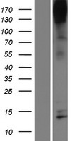 Nephrin (NPHS1) Human Over-expression Lysate