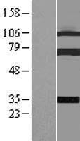 Coilin (COIL) Human Over-expression Lysate