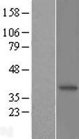 N myc interactor (NMI) Human Over-expression Lysate