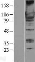 GEF H1 (ARHGEF2) Human Over-expression Lysate