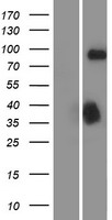 DCAMKL1 (DCLK1) Human Over-expression Lysate