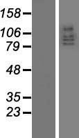 DLG5 Human Over-expression Lysate