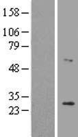 LRAT Human Over-expression Lysate