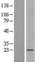 ITGB1BP1 Human Over-expression Lysate